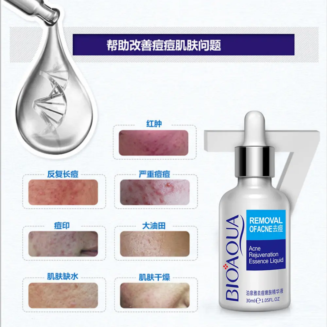 Serum Bioaqua Antiacne