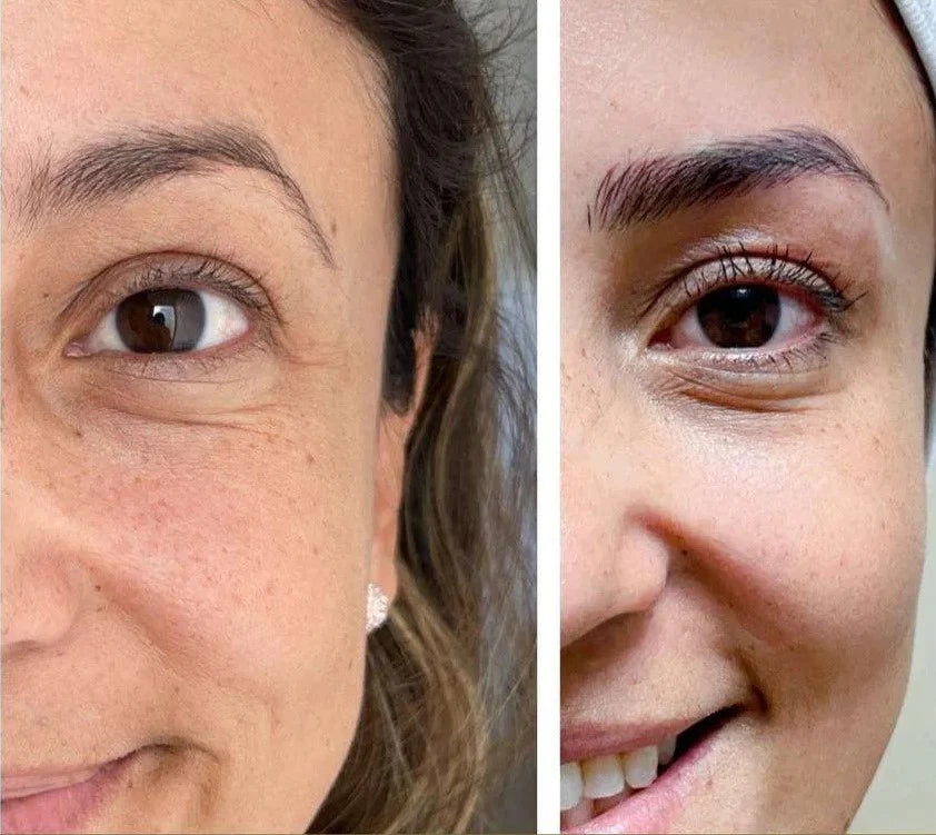 Kit Lujo Facial Retinol Bioaqua